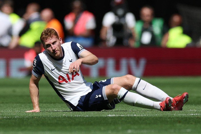 Tottenham Vs Chelsea: Cedera 15 Pemain Spurs, Piala Liga Terancam?