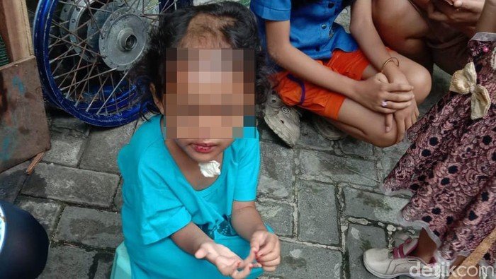 Balita di Surabaya Dianiaya Paman dan Bibi: Pilu Nasib yang Membuat Ngeri dan Mengejutkan